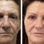 siperstein-makeover2